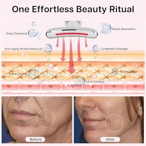 ماساژور زیبایی ۷ در ۱ VRAIKO برای صورت و گردن - لیفت و سفت کردن خط فک - ماساژور تخلیه لنفاوی صورت برای ضد پیری، چین و چروک، خطوط پیشانی و حلقه‌های تیره