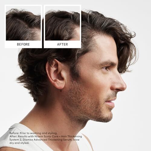 شامپو و نرم‌کننده Nioxin System 2، مناسب برای موهای طبیعی درمان‌شده با نازک‌شدگی پیشرفته، شامل پمپ، 33.8 اونس مایع (بسته‌بندی ممکن است متفاوت باشد) Image