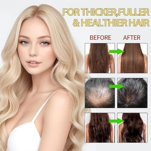 درما رولر برای رشد مو، رشد ریش و جوانسازی پوست - رولر میکرونیدل 0.5 میلی‌متری برای پوست سر، صورت و ریش - ابزار میکرونیدلینگ برای موهای ضخیم‌تر، ضد پیری و مراقبت از پوست