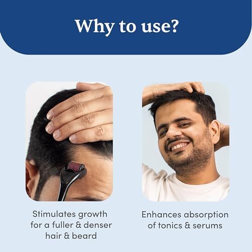 میکرونر درما رولر من متترز با ضدعفونی کننده 540 میکرو 0.5 میلی‌متری سوزن‌های آلیاژ تیتانیوم، ریزش مو را کاهش داده و فولیکول‌های مو را تحریک می‌کند. استفاده آسان، ایمن و مؤثر، 1 عدد (بسته 1) مشکی