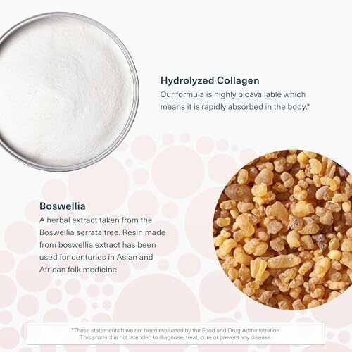 کلاژن پیشرفته یوتئوری - مکمل کلاژن - حمایت و سلامت مفاصل - کلاژن برای استخوان‌ها و مفاصل زنان و مردان - با عصاره بوسولیا، زردچوبه و کوئرستین - 120 قرص Image