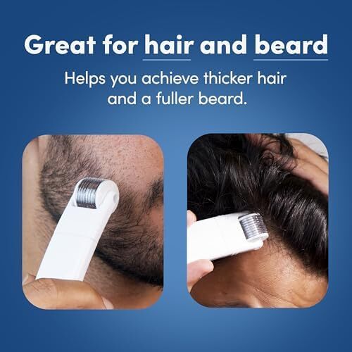 رولر درم ۲ در ۱ من متترز برای مو و ریش | ۵۴۰ سوزن تیتانیوم آلیاژ ۰.۵ میلی‌متری | سر قابل تعویض | تحریک فولیکول‌های مو | رشد مو و ریش را فراهم می‌کند | ایمن و آسان برای استفاده Image
