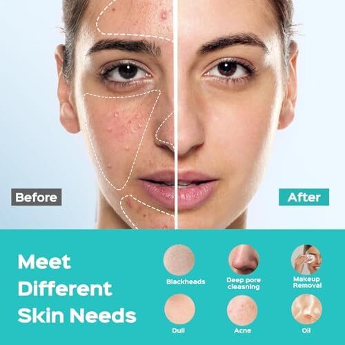 برس پاکسازی صورت: برس صورت شارژی و ضد آب IPX7، سیستم مراقبت سیلیکونی با ۵ حالت پاکسازی برای تمیز کردن، لایه‌برداری و ماساژ Image